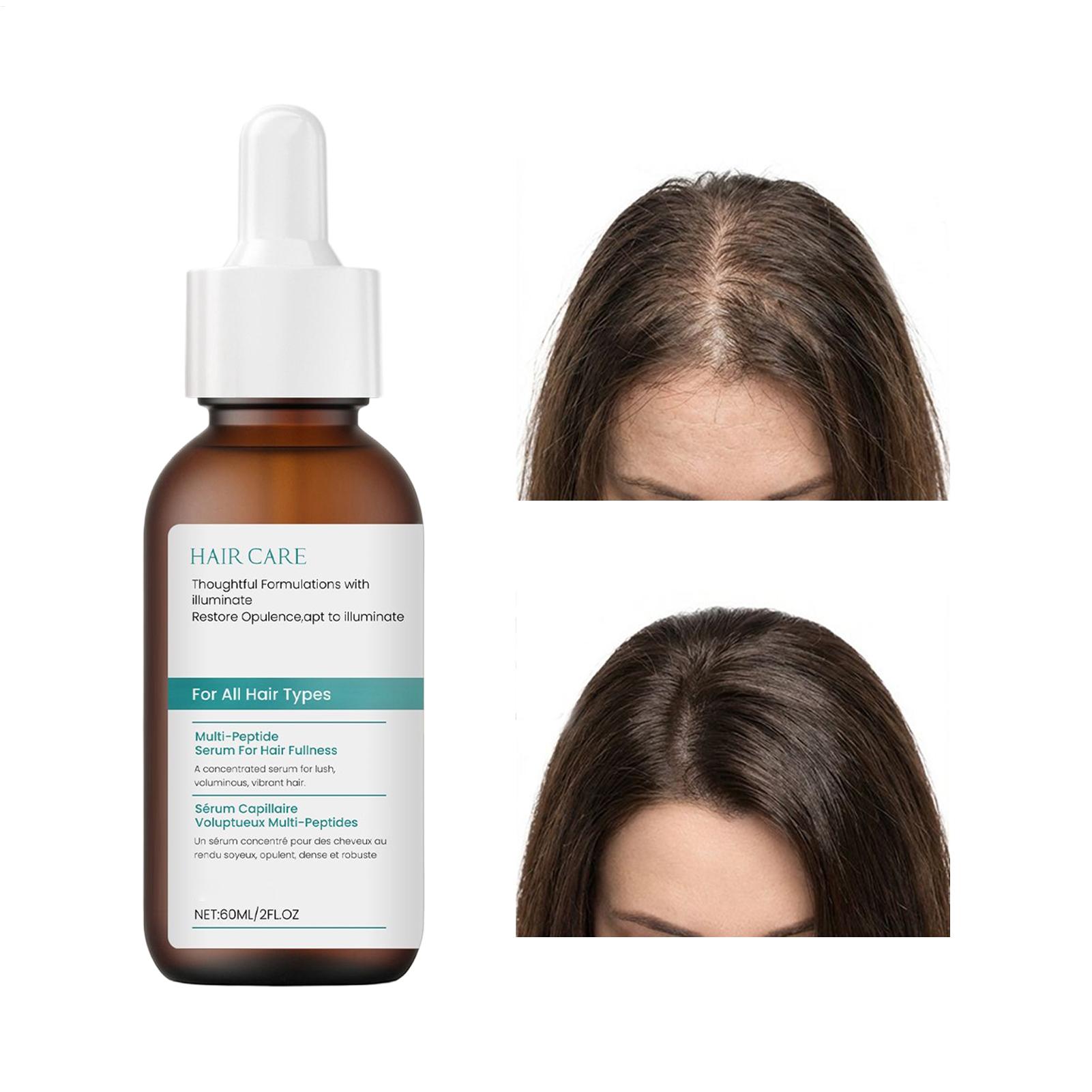 60Ml Serum Rambut Peptida Cair - Root Stimulator Liquid ulasan dan harga